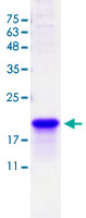 SDS-PAGE (3ug/lane) stained with Coomassie Blue